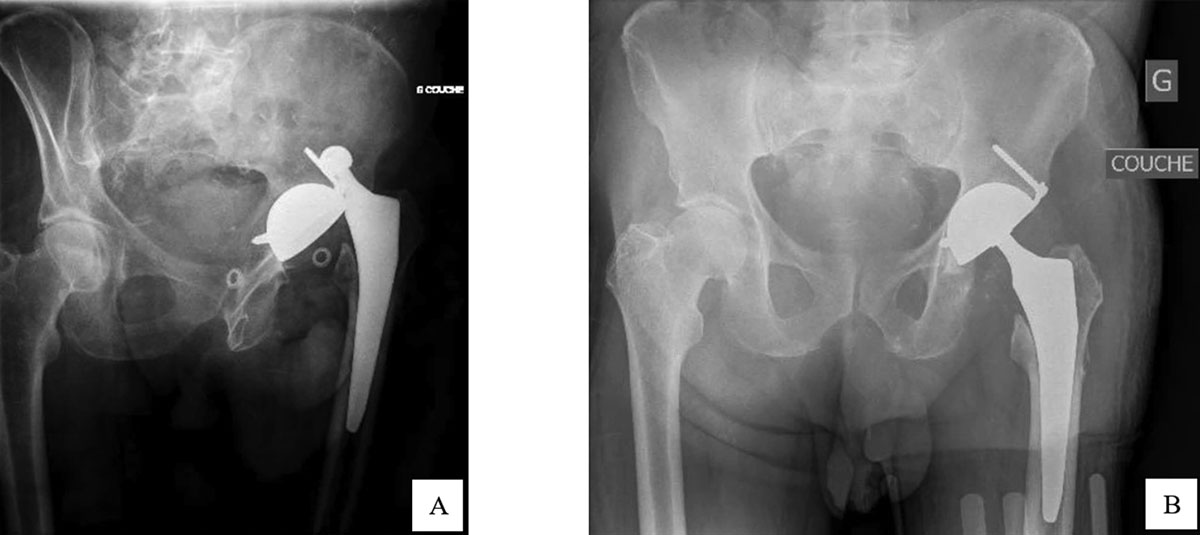 Figure 2 Refer to the following caption and surrounding text.