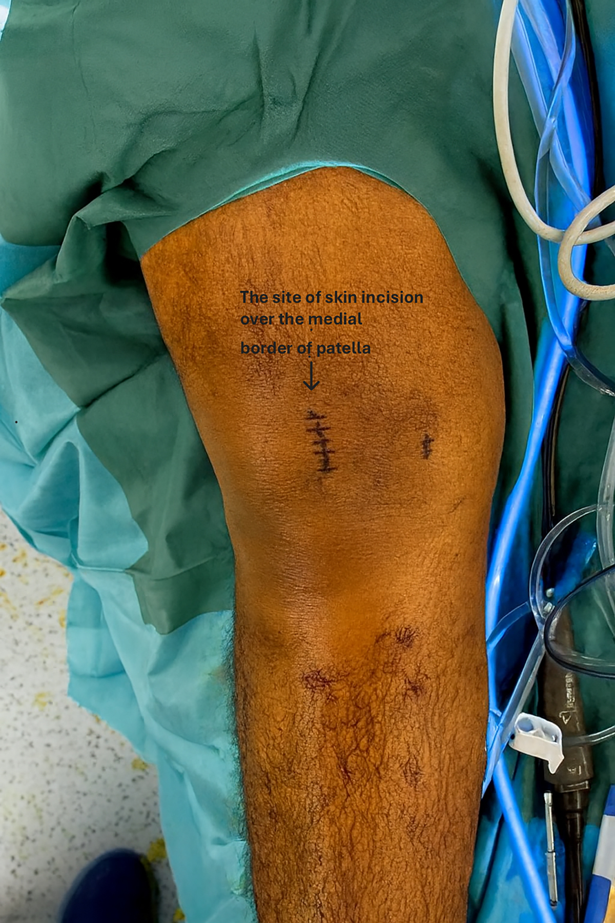 Figure 1 Refer to the following caption and surrounding text.