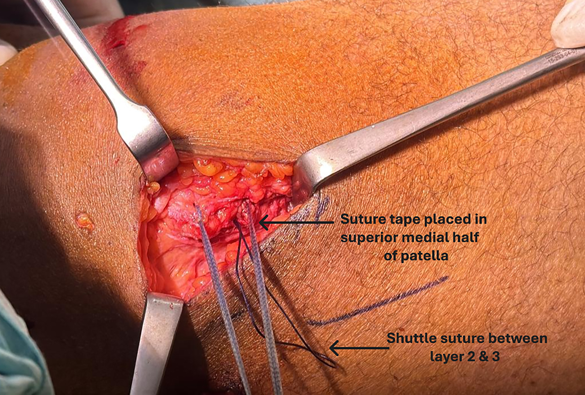 Figure 2 Refer to the following caption and surrounding text.