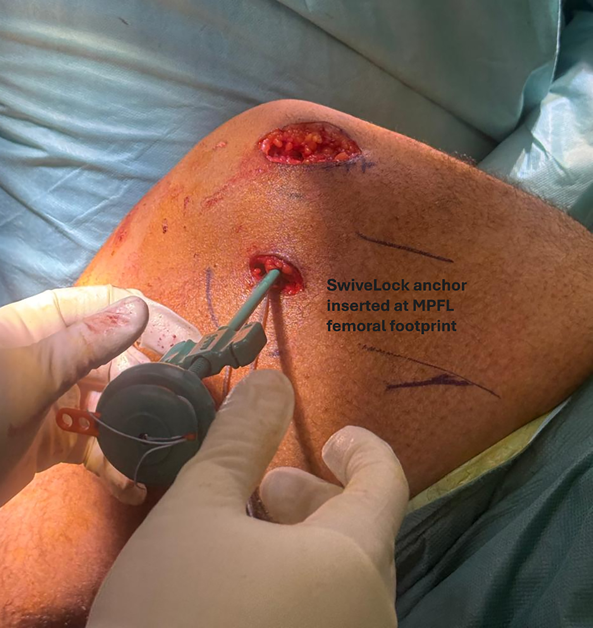 Figure 3 Refer to the following caption and surrounding text.