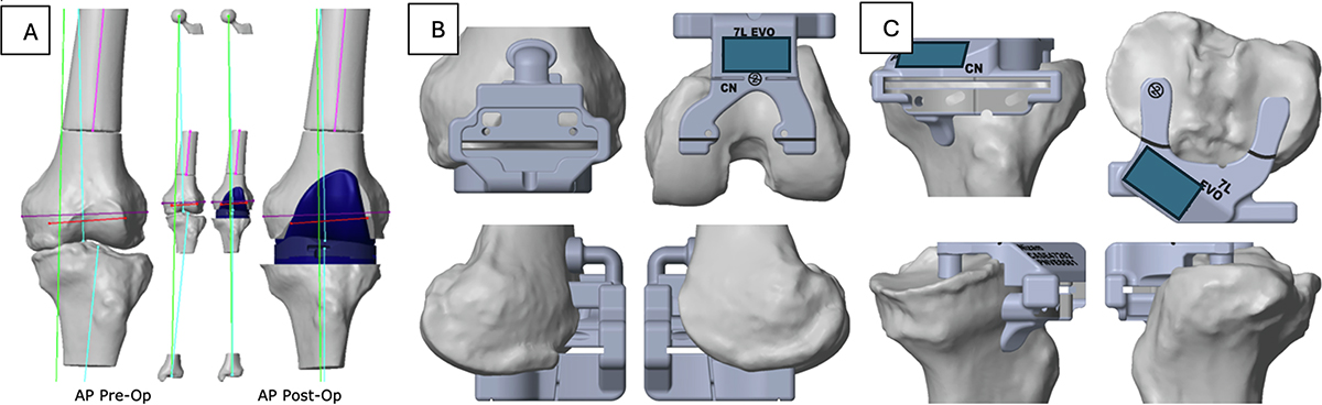 Figure 2 Refer to the following caption and surrounding text.
