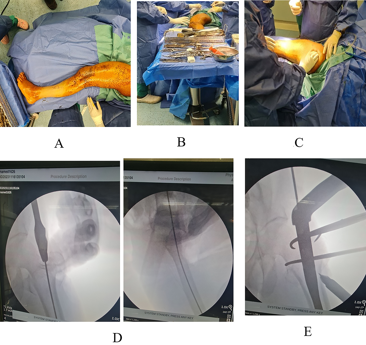 Figure 1 Refer to the following caption and surrounding text.