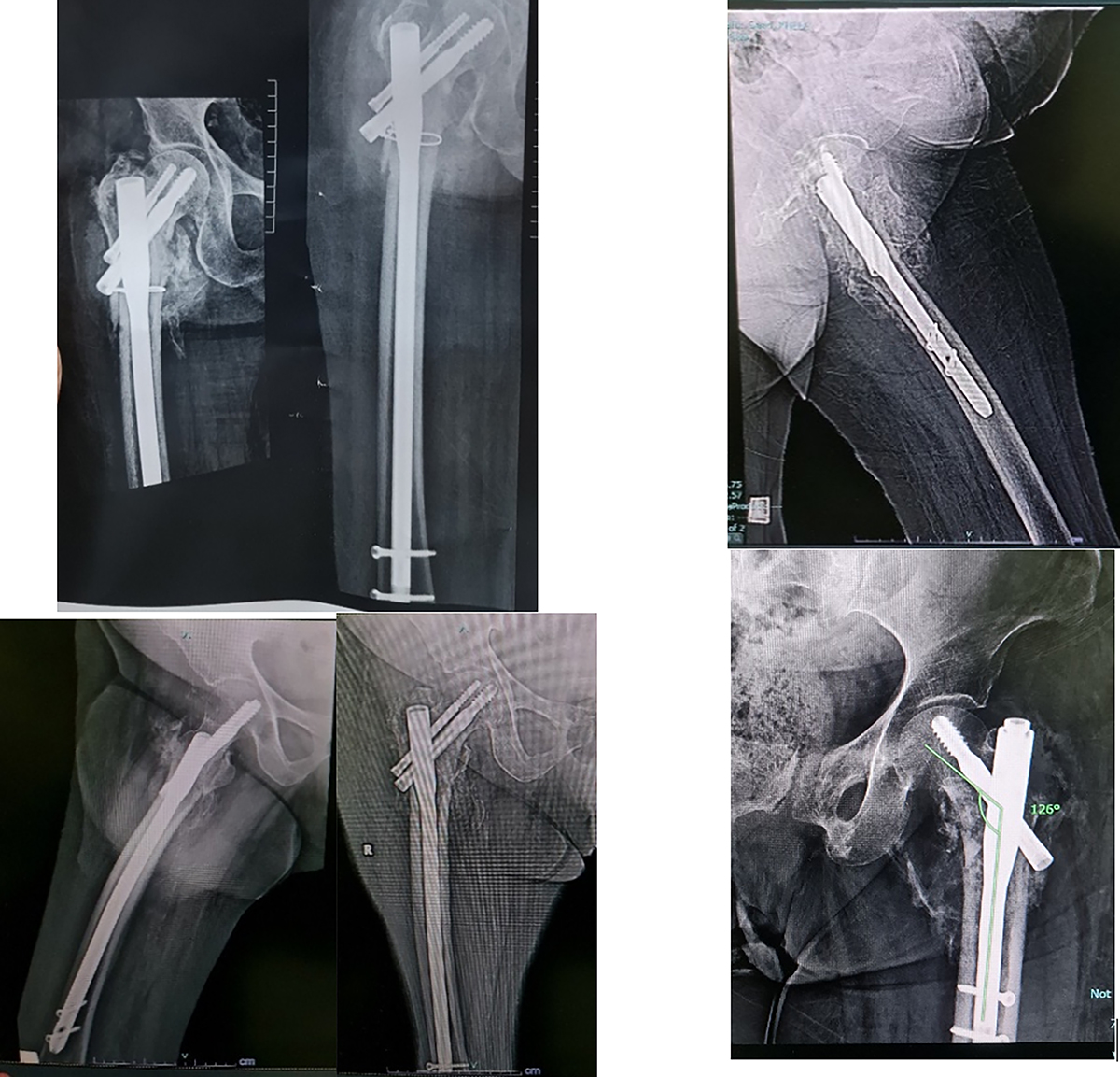 Figure 3 Refer to the following caption and surrounding text.