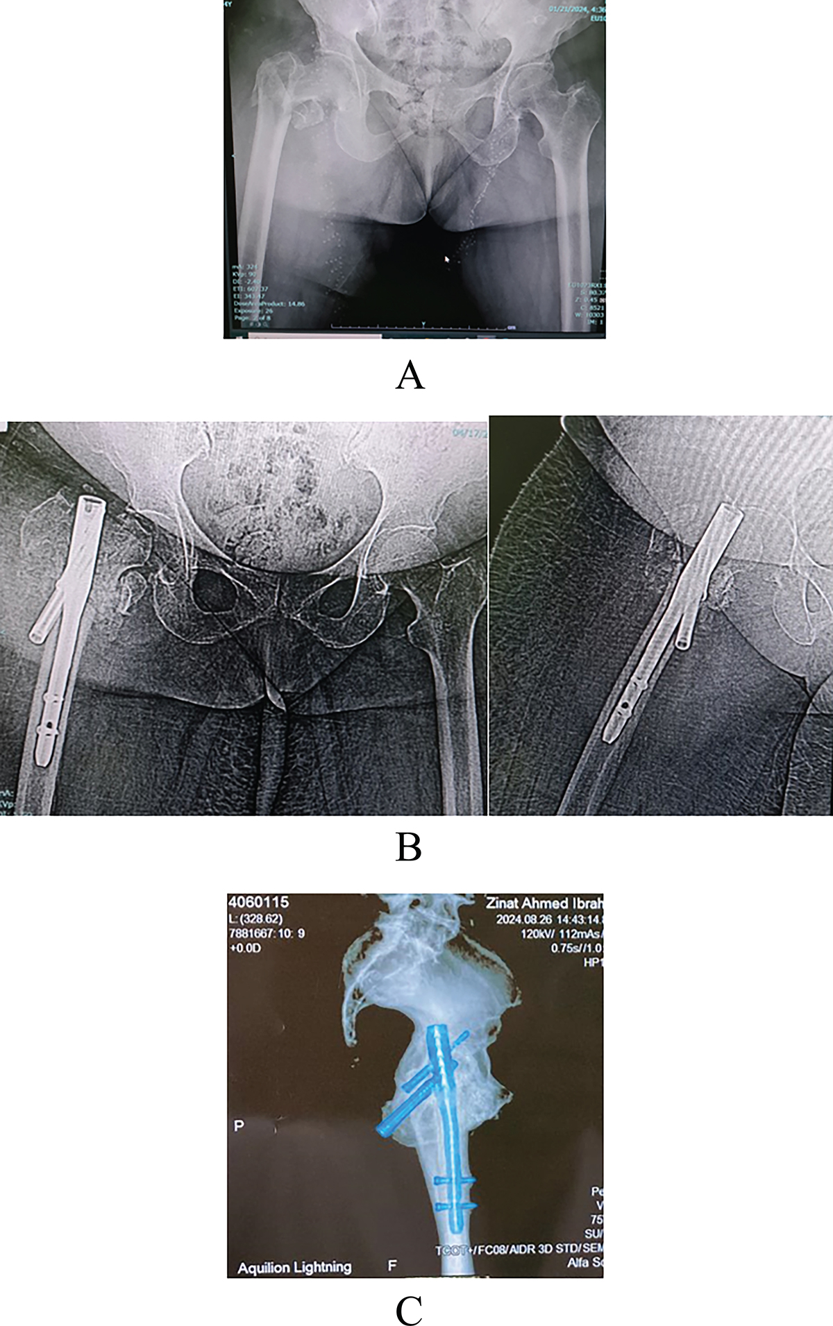 Figure 4 Refer to the following caption and surrounding text.