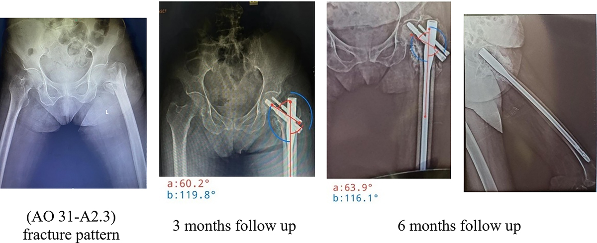 Figure 5 Refer to the following caption and surrounding text.
