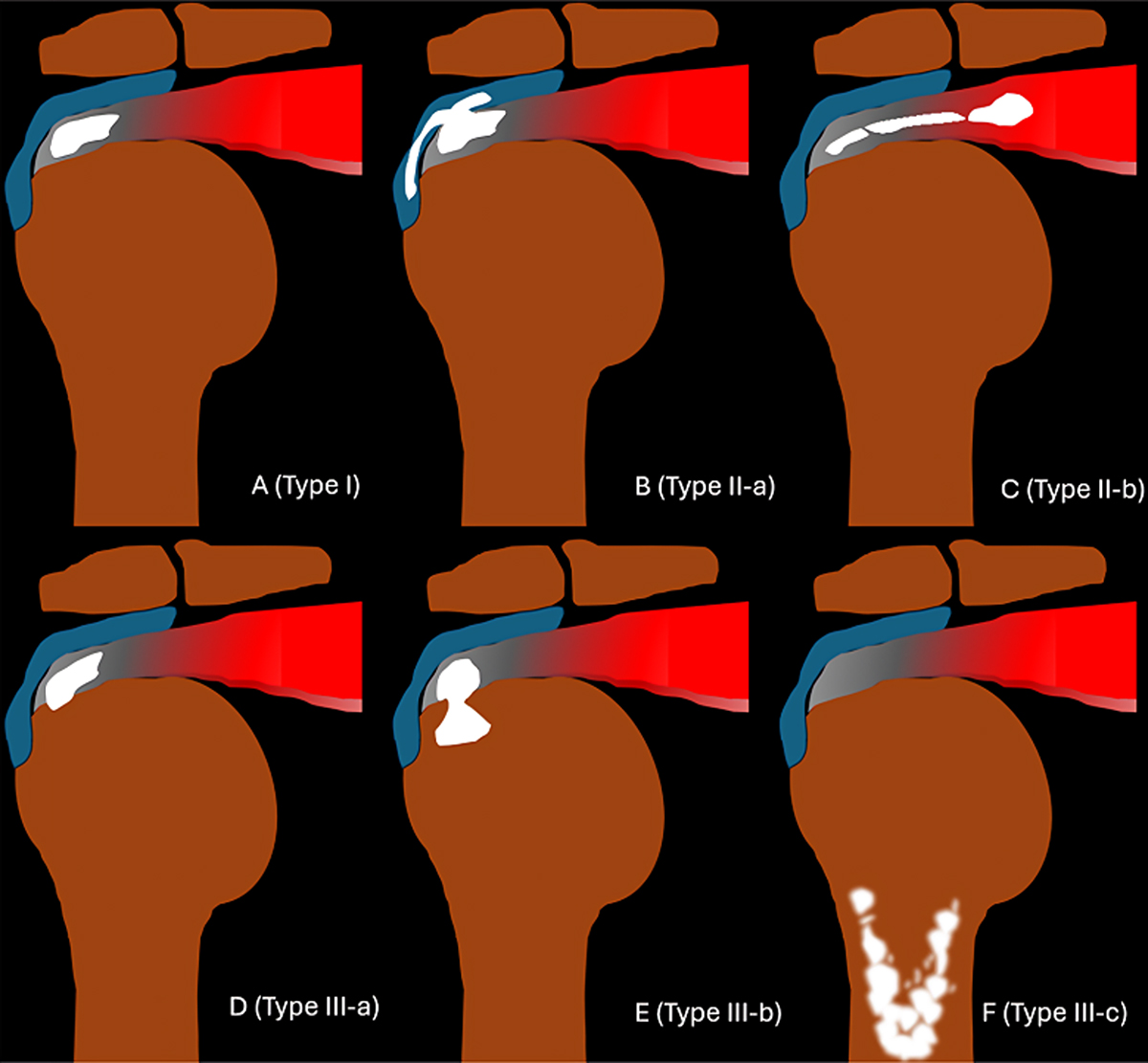 Figure 1 Refer to the following caption and surrounding text.