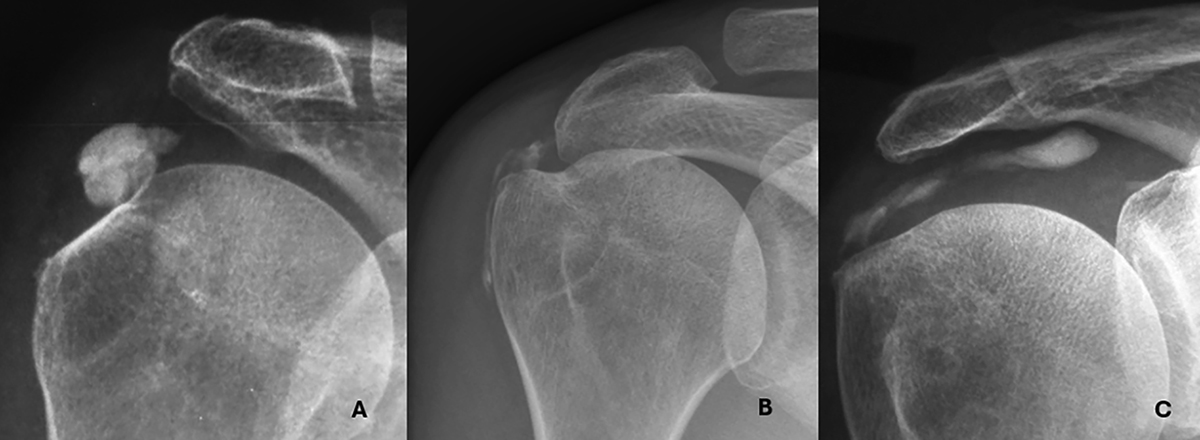 Figure 2 Refer to the following caption and surrounding text.