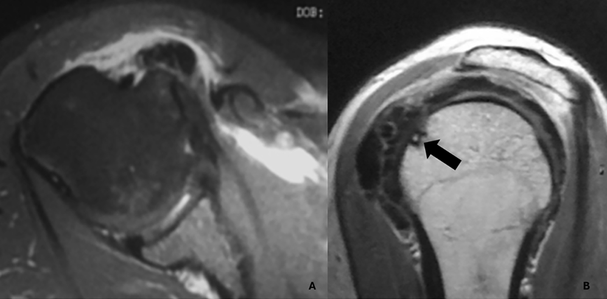 Figure 3 Refer to the following caption and surrounding text.