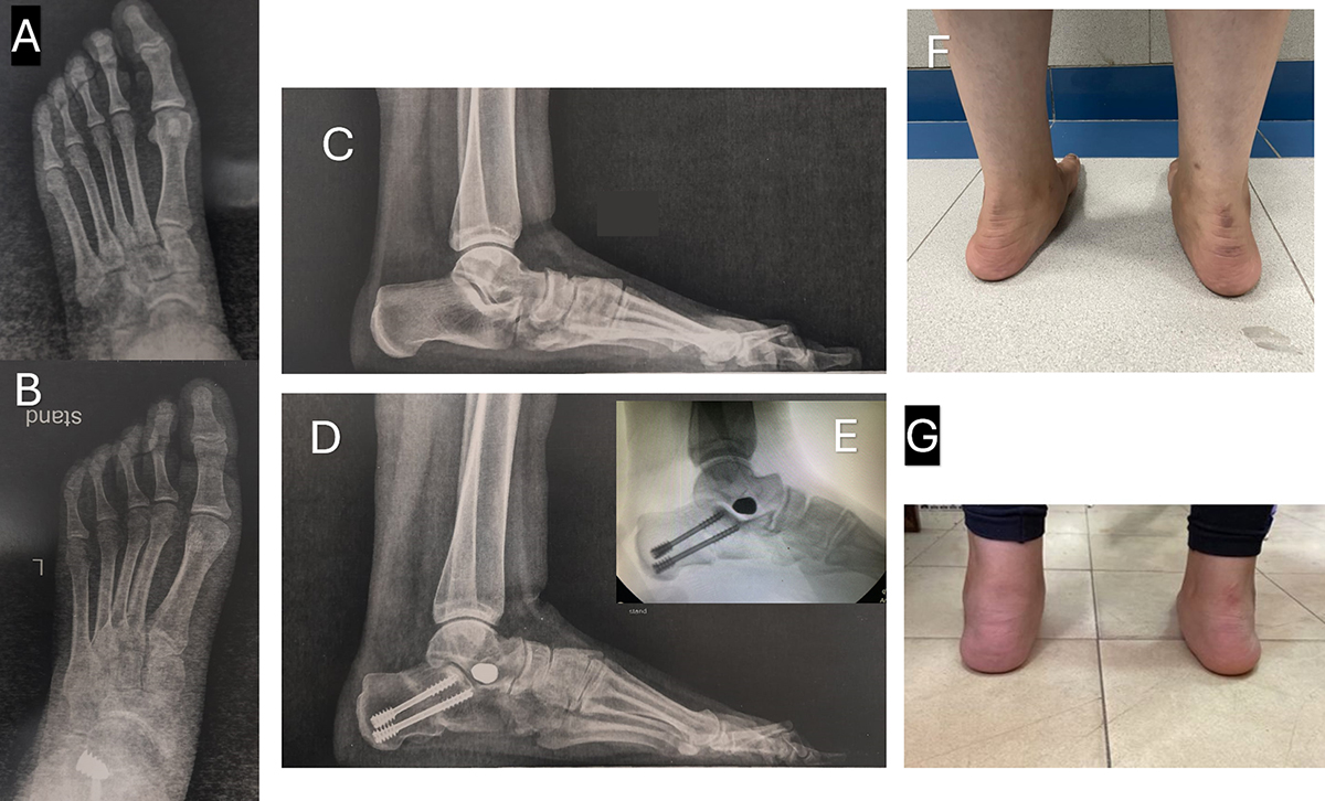 Figure 4 Refer to the following caption and surrounding text.
