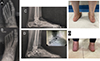 Thumbnail: Figure 4 Refer to the following caption and surrounding text.