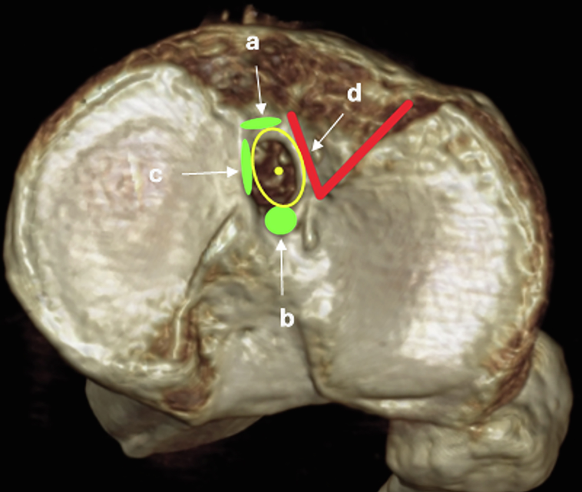 Figure 1 Refer to the following caption and surrounding text.