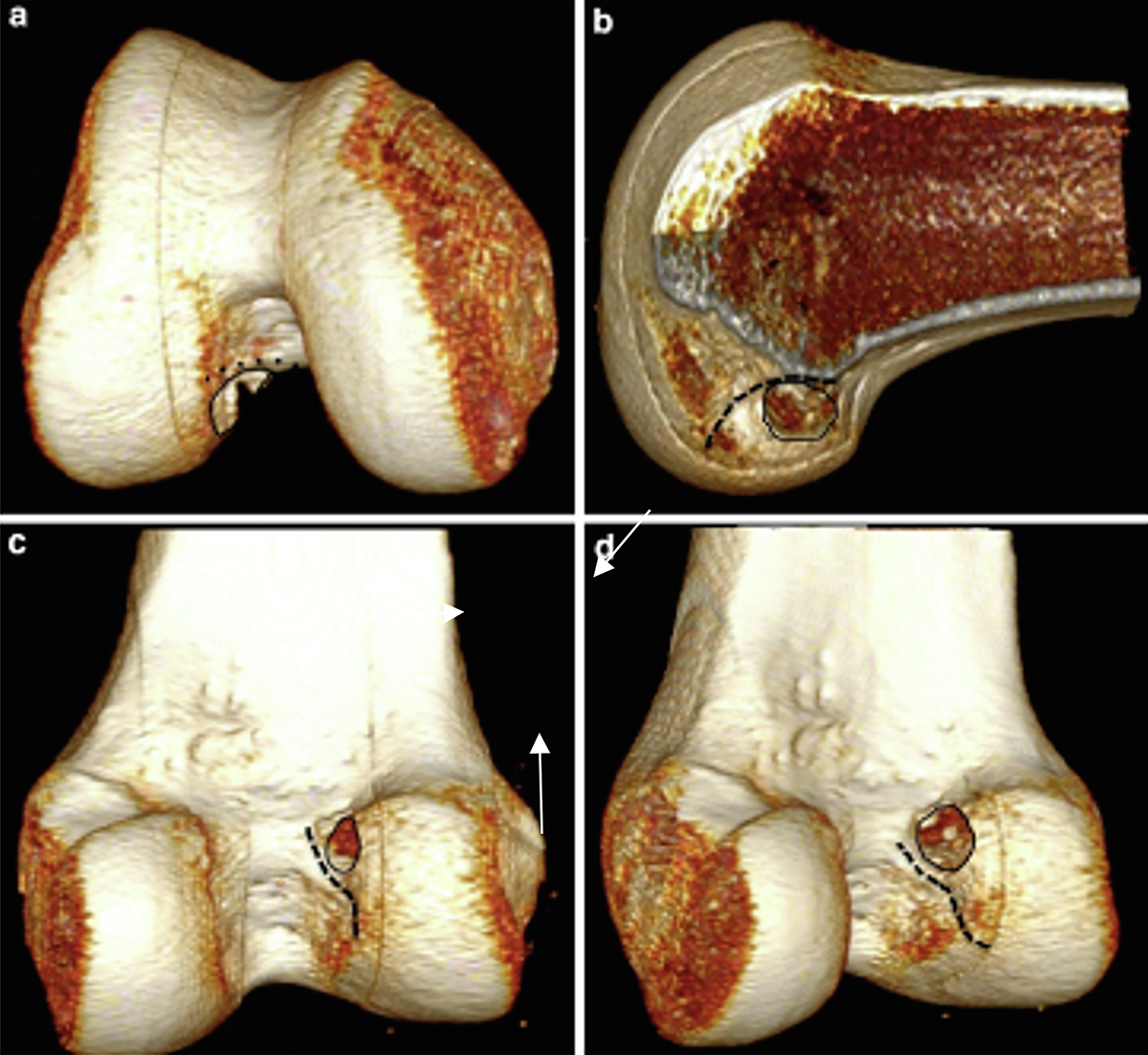 Figure 2 Refer to the following caption and surrounding text.