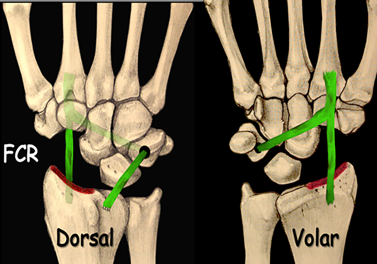Figure 3 Refer to the following caption and surrounding text.