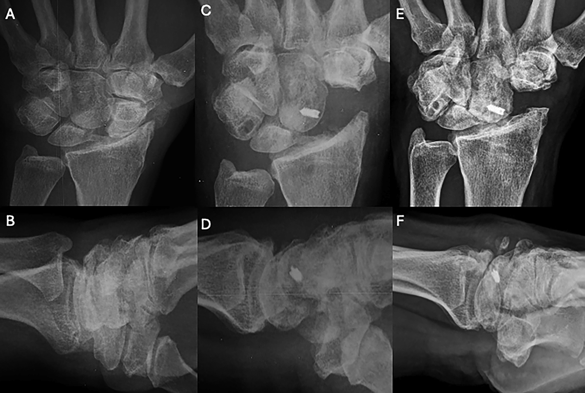 Figure 4 Refer to the following caption and surrounding text.