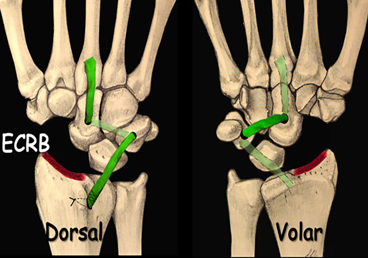 Figure 5 Refer to the following caption and surrounding text.