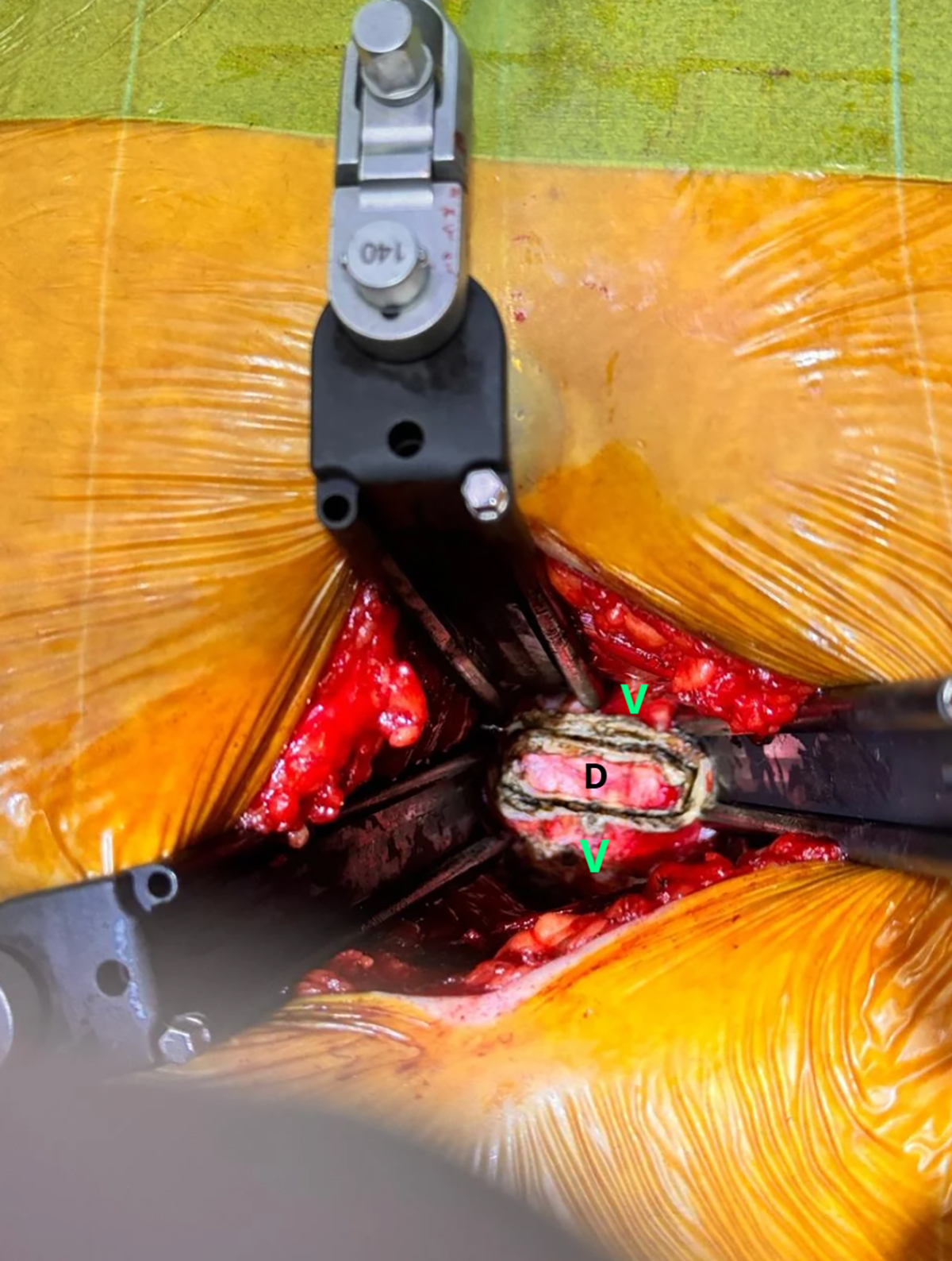 Figure 2 Refer to the following caption and surrounding text.