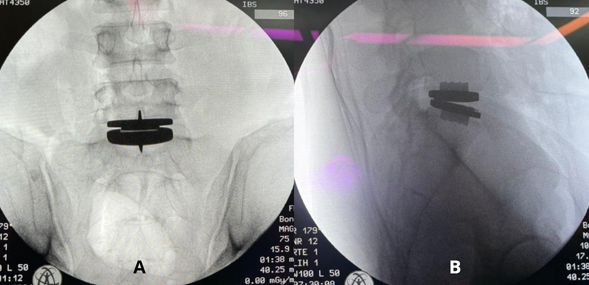 Figure 7 Refer to the following caption and surrounding text.