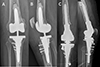 Thumbnail: Figure 4 Refer to the following caption and surrounding text.