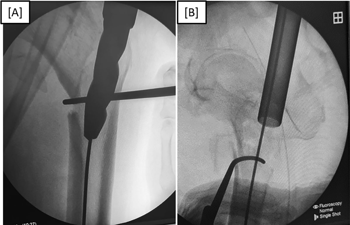 Figure 5 Refer to the following caption and surrounding text.
