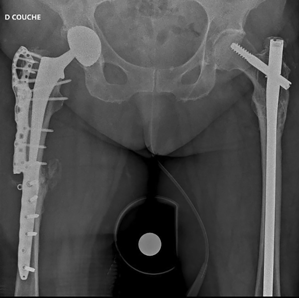 Figure 4 Refer to the following caption and surrounding text.