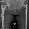 Thumbnail: Figure 4 Refer to the following caption and surrounding text.