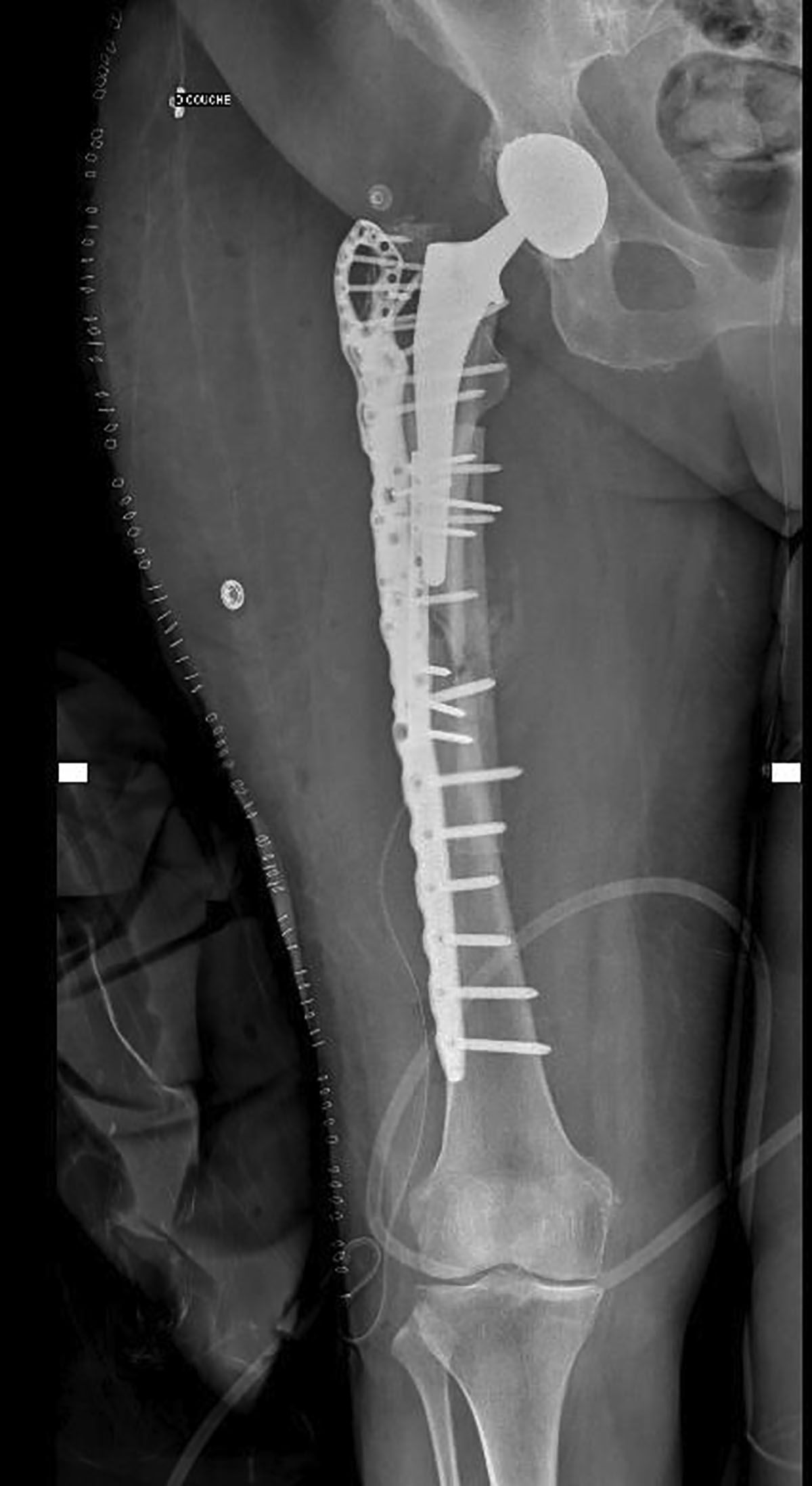 Figure 5 Refer to the following caption and surrounding text.
