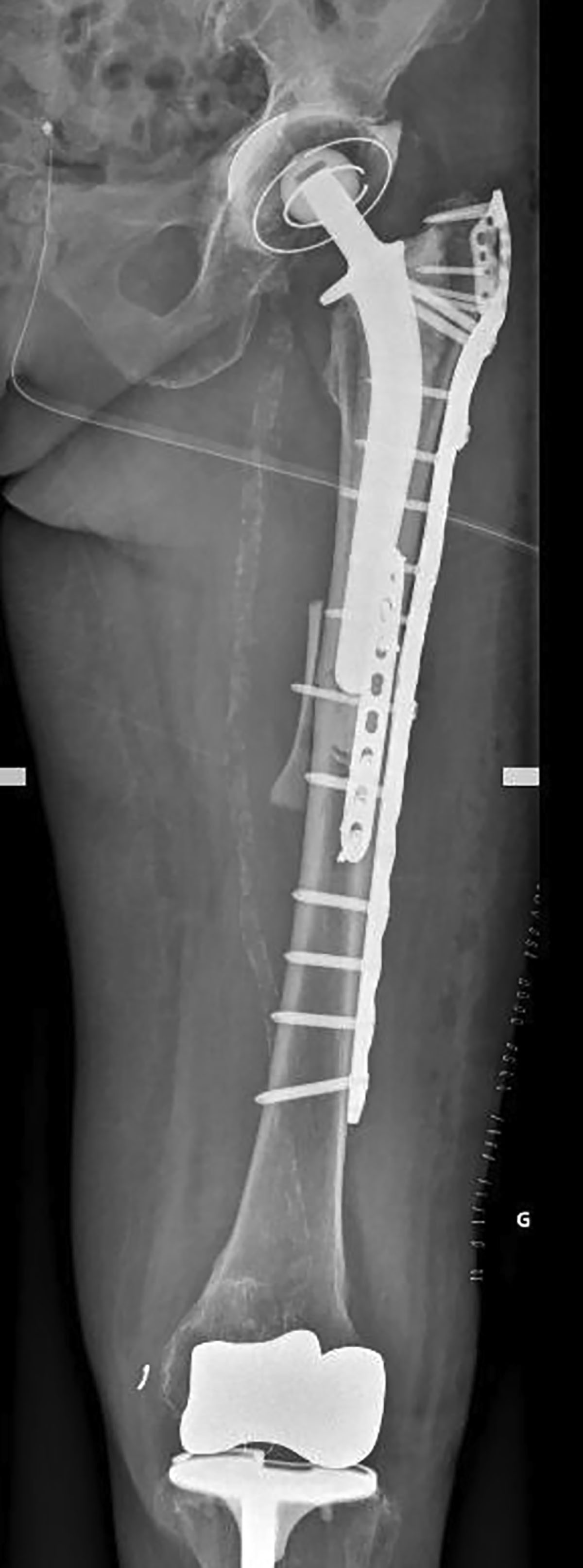 Figure 9 Refer to the following caption and surrounding text.