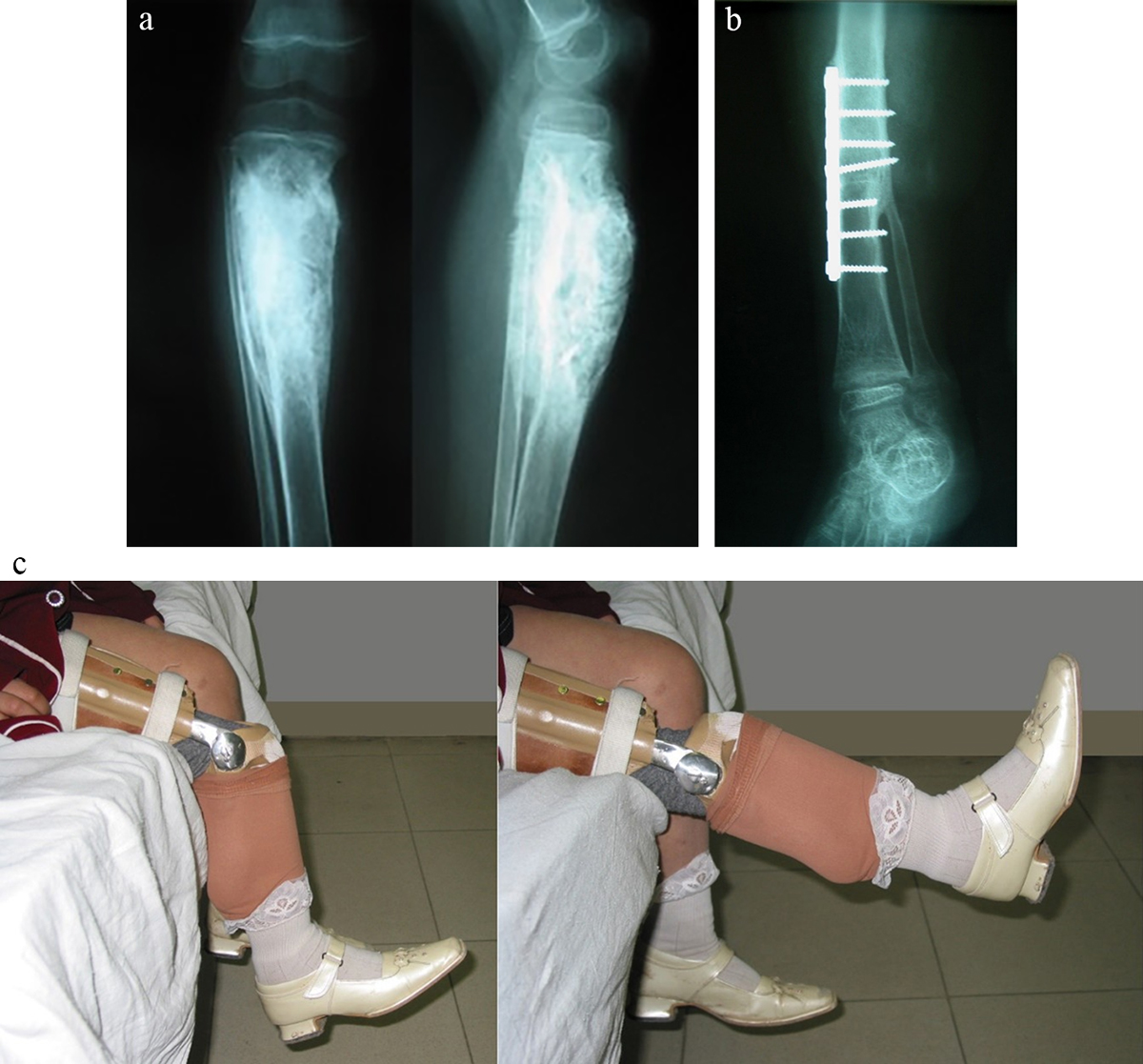 Figure 2 Refer to the following caption and surrounding text.