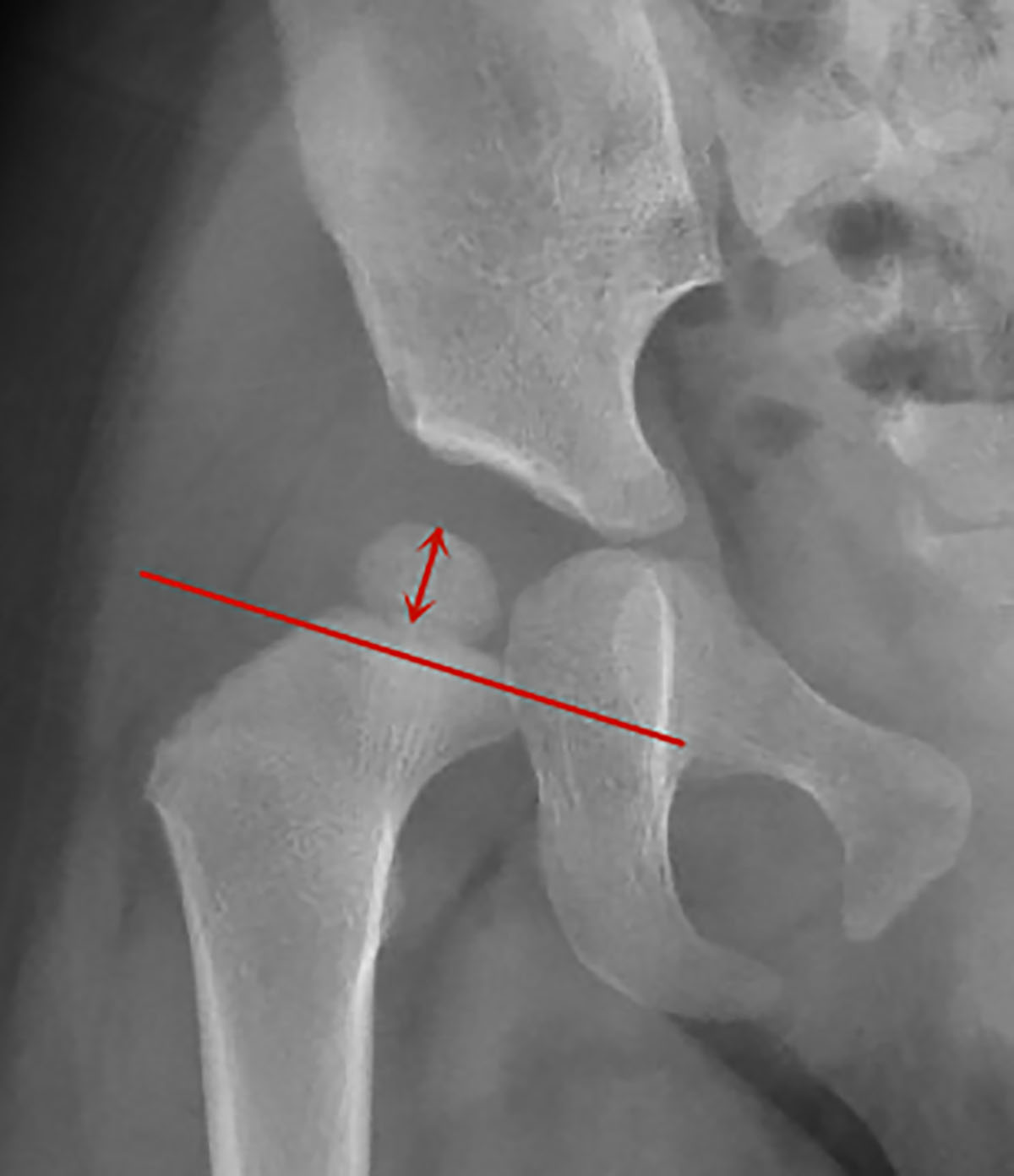 Figure 1 Refer to the following caption and surrounding text.