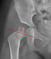 Thumbnail: Figure 1 Refer to the following caption and surrounding text.