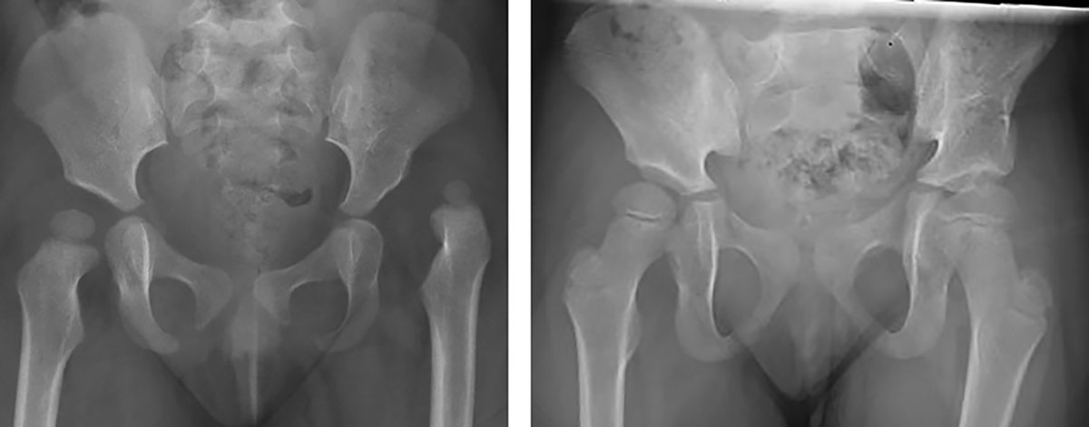 Figure 2 Refer to the following caption and surrounding text.
