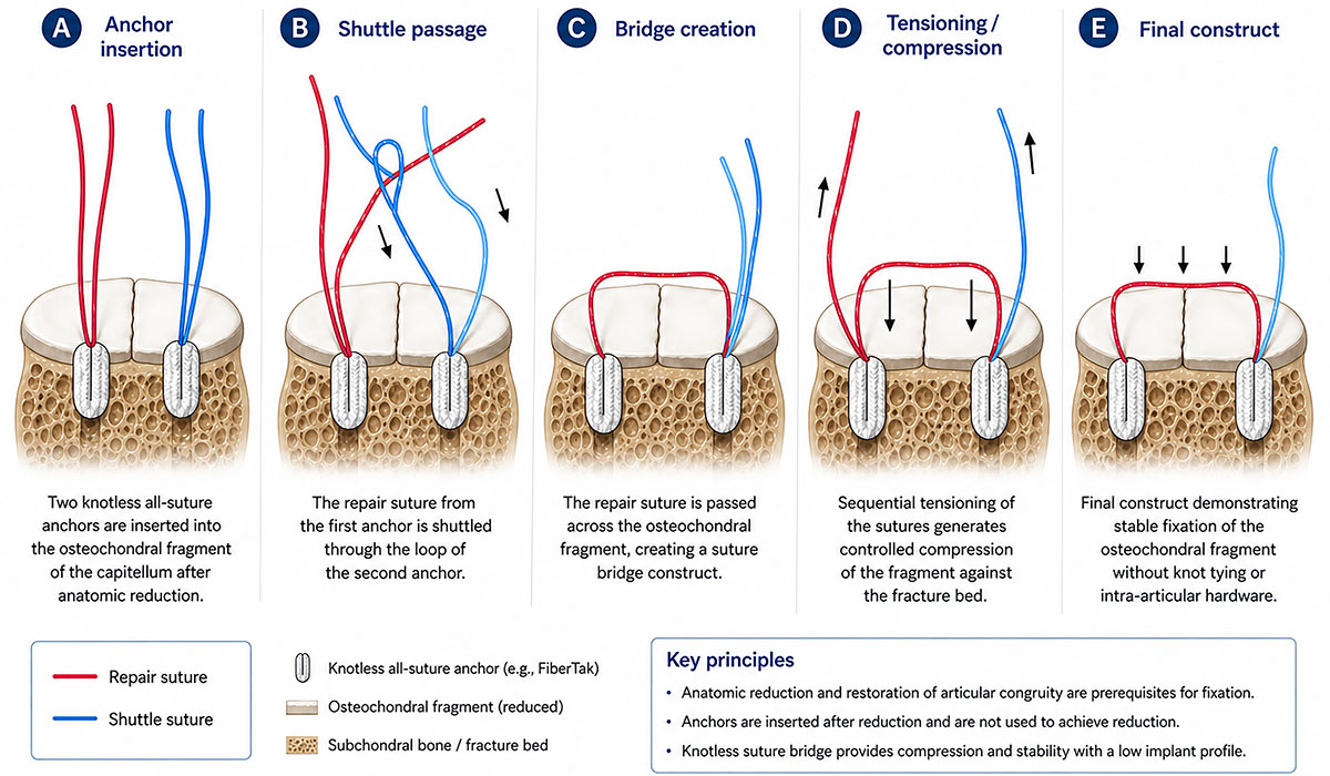 Figure 2 Refer to the following caption and surrounding text.