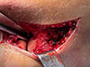 Thumbnail: Figure 3 Refer to the following caption and surrounding text.