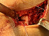 Thumbnail: Figure 5 Refer to the following caption and surrounding text.