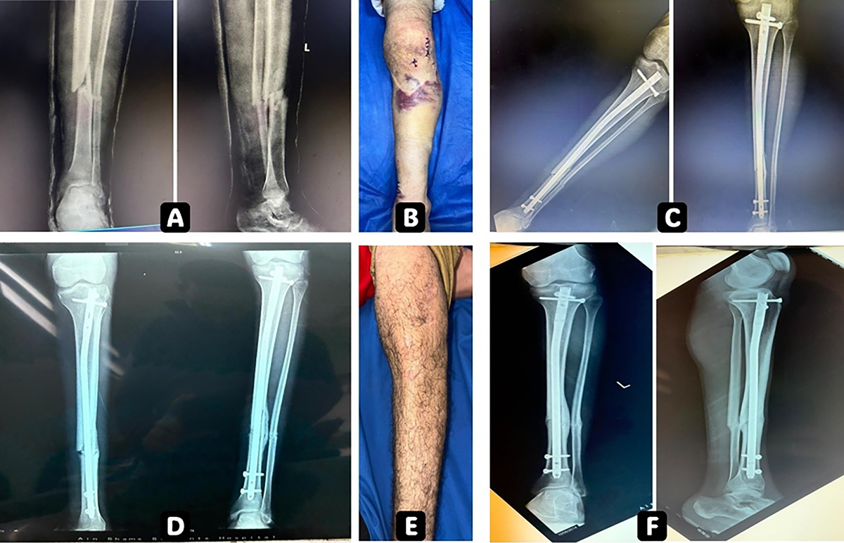 Figure 2 Refer to the following caption and surrounding text.