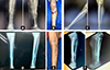 Thumbnail: Figure 2 Refer to the following caption and surrounding text.